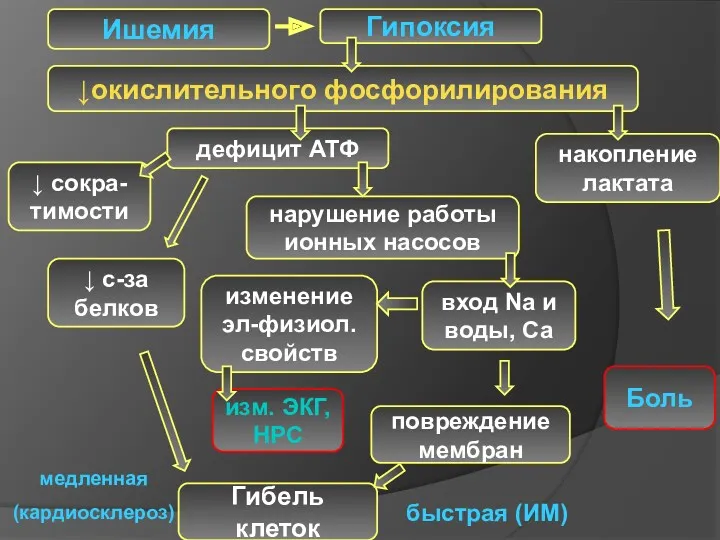 Ишемия Гипоксия ↓окислительного фосфорилирования дефицит АТФ накопление лактата Боль ↓