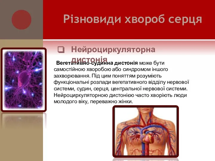 Вегетативно-судинна дистонія може бути самостійною хворобою або синдромом іншого захворювання.