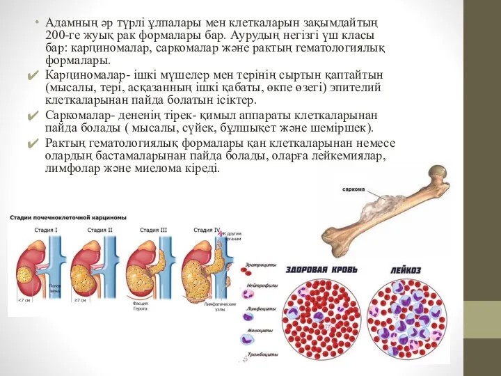 Адамның әр түрлі ұлпалары мен клеткаларын зақымдайтың 200-ге жуық рак