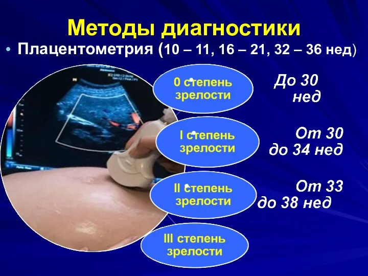 Методы диагностики Плацентометрия (10 – 11, 16 – 21, 32 – 36 нед)