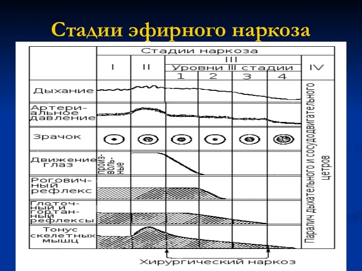 Стадии эфирного наркоза