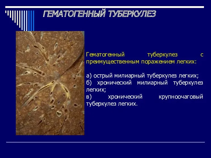 ГЕМАТОГЕННЫЙ ТУБЕРКУЛЕЗ Гематогенный туберкулез с преимущественным поражением легких: а) острый