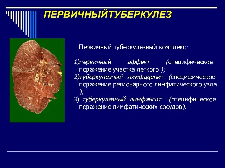 ПЕРВИЧНЫЙТУБЕРКУЛЕЗ Первичный туберкулезный комплекс: первичный аффект (специфическое поражение участка легкого