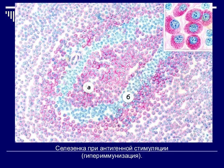 Селезенка при антигенной стимуляции (гипериммунизация).