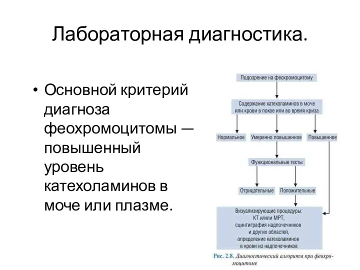 Лабораторная диагностика. Основной критерий диагноза феохромоцитомы — повышенный уровень катехоламинов в моче или плазме.