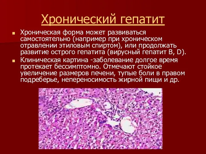 Хронический гепатит Хроническая форма может развиваться самостоятельно (например при хроническом