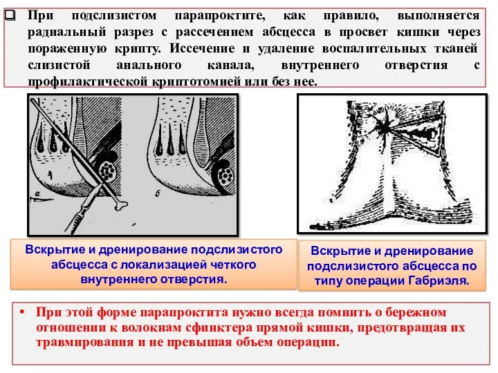 При подслизистом парапроктите, как правило, выполняется радиальный разрез с рассечением