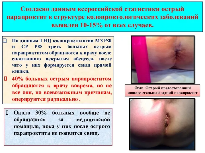 Согласно данным всероссийской статистики острый парапроктит в структуре колопроктологических заболеваний