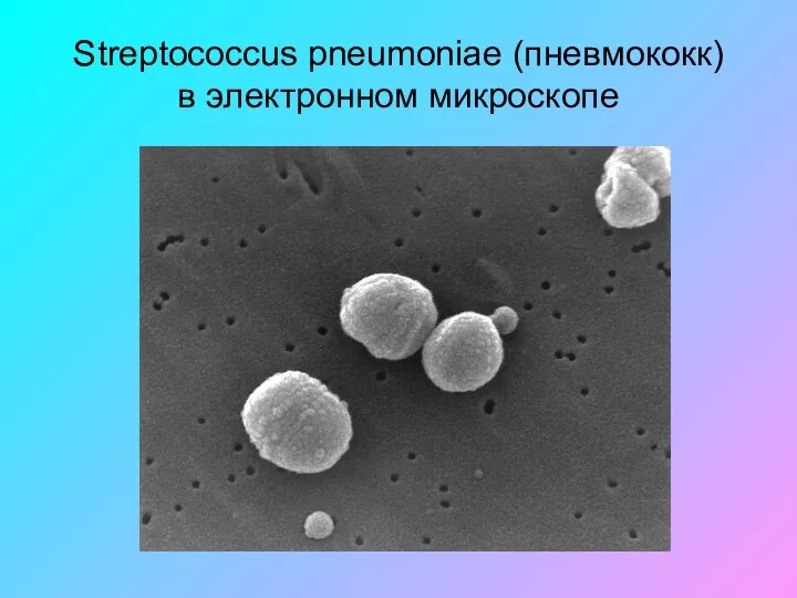 Streptococcus pneumoniae (пневмококк) в электронном микроскопе