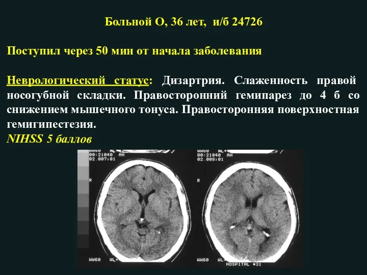 Больной О, 36 лет, и/б 24726 Поступил через 50 мин от начала заболевания