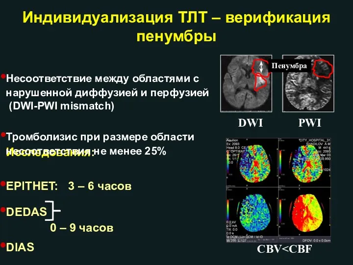 Индивидуализация ТЛТ – верификация пенумбры Исследования: EPITHET: 3 – 6