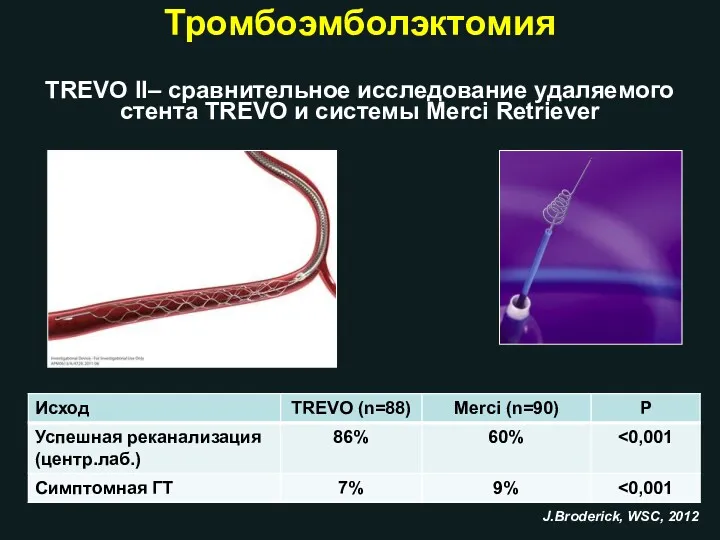 TREVO II– сравнительное исследование удаляемого стента TREVO и системы Merci Retriever J.Broderick, WSC, 2012 Тромбоэмболэктомия