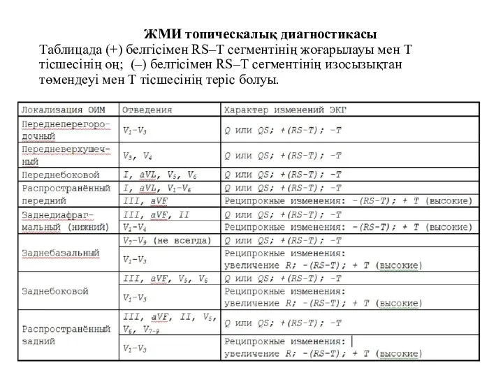 ЖМИ топическалық диагностикасы Таблицада (+) белгісімен RS–Т сегментінің жоғарылауы мен