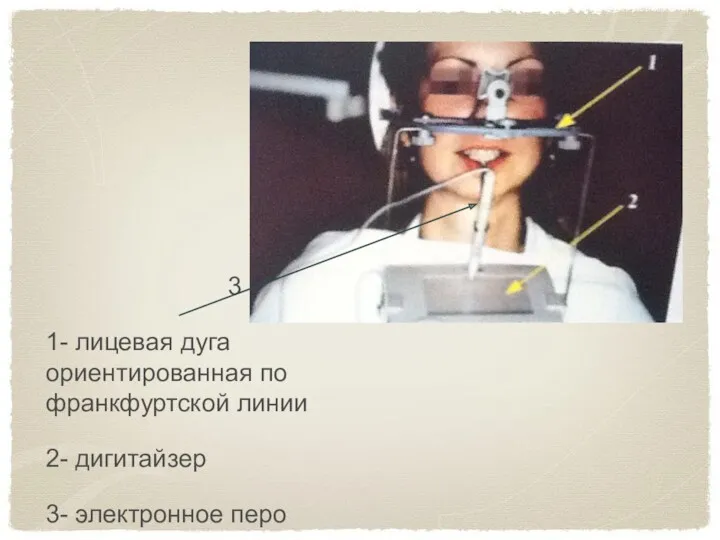 3 1- лицевая дуга ориентированная по франкфуртской линии 2- дигитайзер 3- электронное перо