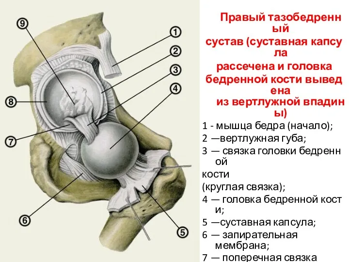 Правый тазобедренный сустав (суставная капсула рассечена и головка бедренной кости