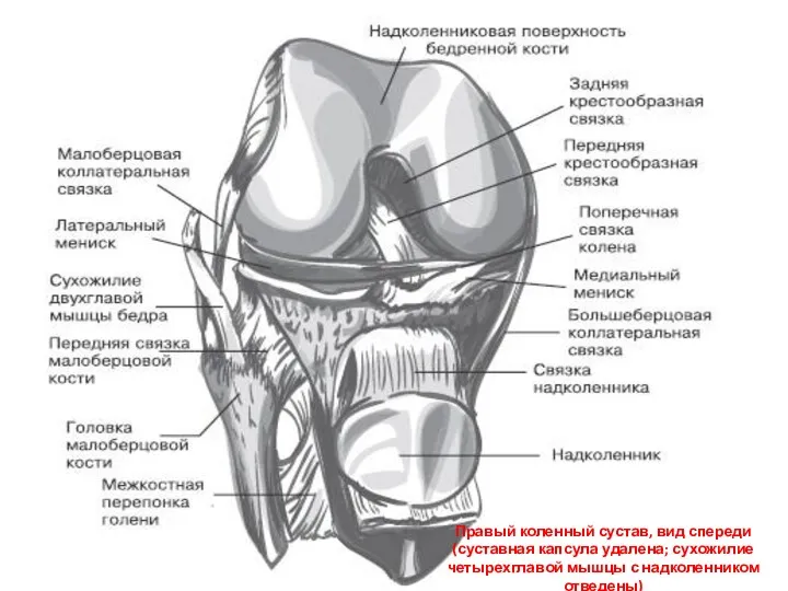 Правый коленный сустав, вид спереди (суставная капсула удалена; сухожилие четырехглавой мышцы с надколенником отведены)