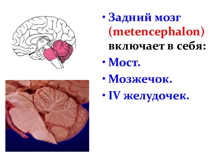 Задний мозг (metencephalon) включает в себя: Мост. Мозжечок. IV желудочек.