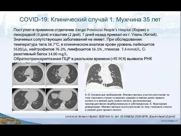 COVID-19: Клинический случай 1. Мужчина 35 лет Поступил в приемное