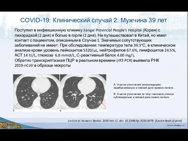 COVID-19: Клинический случай 2. Мужчина 39 лет Поступил в инфекционную