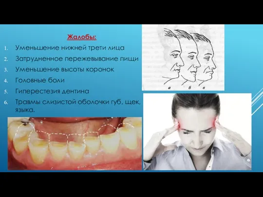 Жалобы: Уменьшение нижней трети лица Затрудненное пережевывание пищи Уменьшение высоты