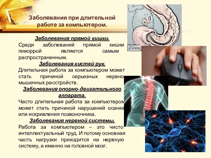 Заболевания при длительной работе за компьютером. Заболевания прямой кишки. Среди