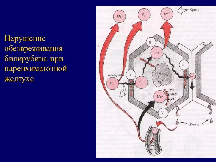 Нарушение обезвреживания билирубина при паренхиматозной желтухе