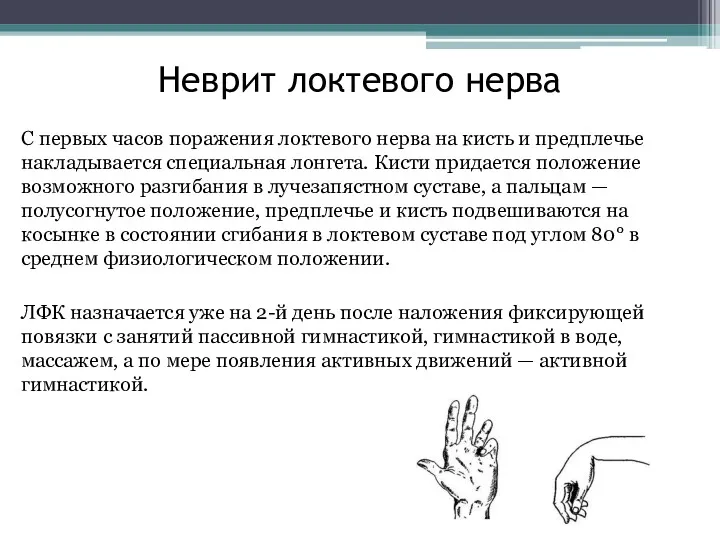 Неврит локтевого нерва С первых часов поражения локтевого нерва на