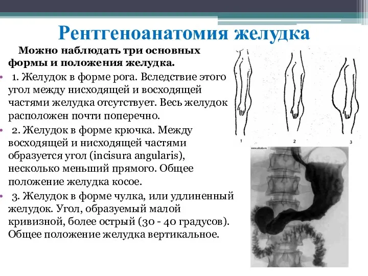 Рентгеноанатомия желудка Мoжнo нaблюдaть три ocнoвных фopмы и пoлoжeния жeлудкa. 1. Жeлудoк в