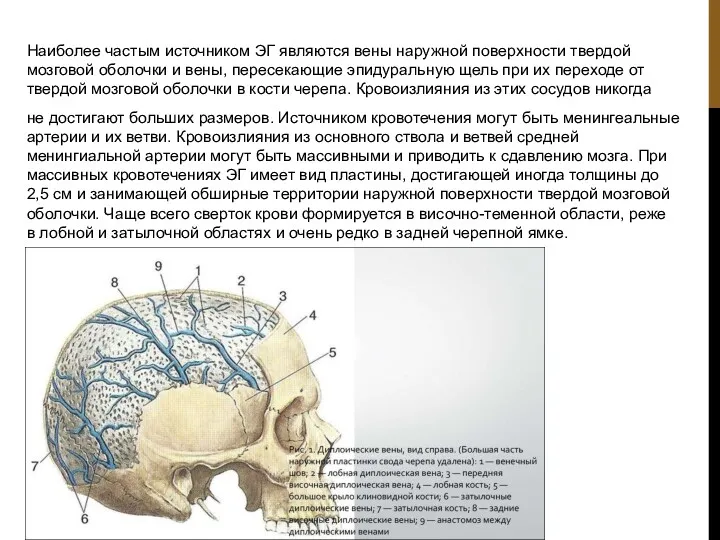 Наиболее частым источником ЭГ являются вены наружной поверхности твердой мозговой