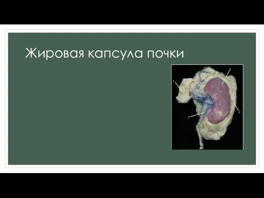 Жировая капсула почки