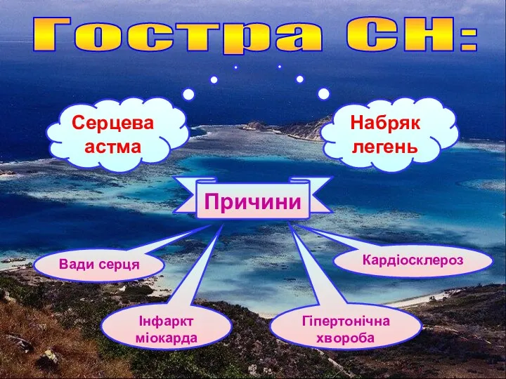 Гостра СН: Серцева астма Набряк легень Причини Вади серця Інфаркт міокарда Гіпертонічна хвороба Кардіосклероз