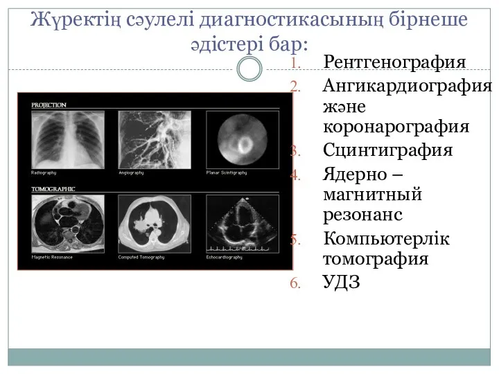 Жүректің сәулелі диагностикасының бірнеше әдістері бар: Рентгенография Ангикардиография және коронарография