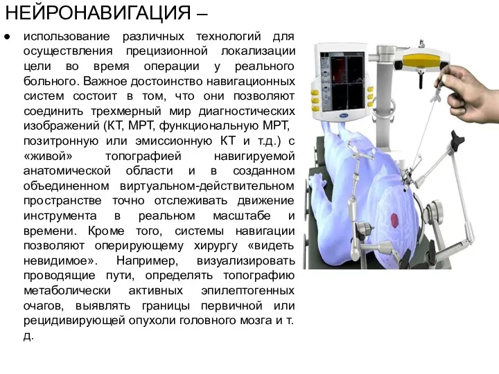 НЕЙРОНАВИГАЦИЯ – использование различных технологий для осуществления прецизионной локализации цели