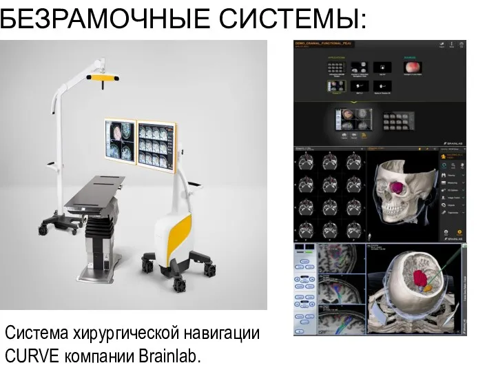 БЕЗРАМОЧНЫЕ СИСТЕМЫ: Система хирургической навигации CURVE компании Brainlab.