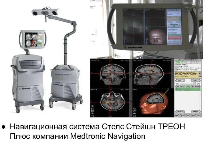 Навигационная система Стелс Стейшн ТРЕОН Плюс компании Medtronic Navigation