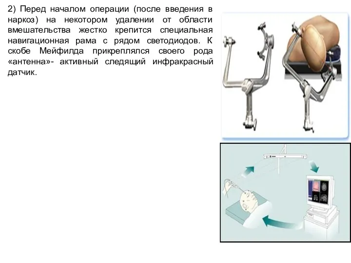 2) Перед началом операции (после введения в наркоз) на некотором