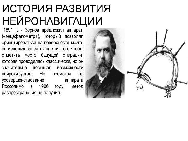 ИСТОРИЯ РАЗВИТИЯ НЕЙРОНАВИГАЦИИ 1891 г. - Зернов предложил аппарат («энцефалометр»),