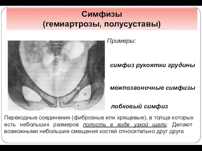 лобковый симфиз Симфизы (гемиартрозы, полусуставы) Примеры: симфиз рукоятки грудины межпозвоночные