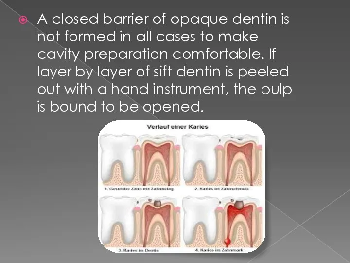A closed barrier of opaque dentin is not formed in