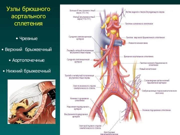 Чревные Верхний брыжеечный Аортопочечные Нижний брыжеечный Узлы брюшного аортального сплетения