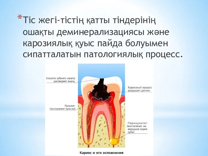 Тіс жегі-тістің қатты тіндерінің ошақты деминерализациясы және карозиялық қуыс пайда болуымен сипатталатын патологиялық процесс.