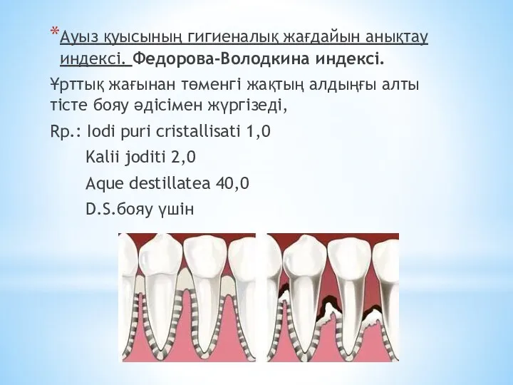 Ауыз қуысының гигиеналық жағдайын анықтау индексі. Федорова-Володкина индексі. Ұрттық жағынан