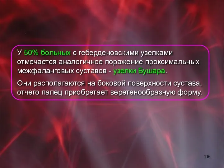 У 50% больных с геберденовскими узелками отмечается аналогичное поражение проксимальных