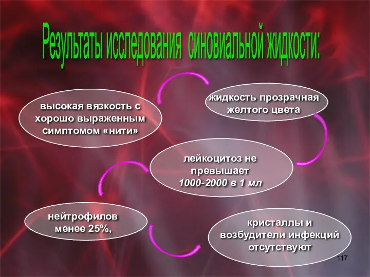 Результаты исследования синовиальной жидкости: высокая вязкость с хорошо выраженным симптомом