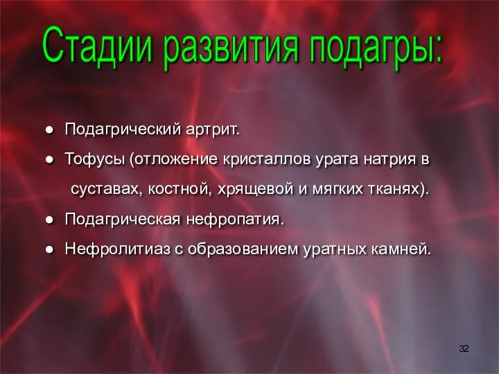 Подагрический артрит. Тофусы (отложение кристаллов урата натрия в суставах, костной,