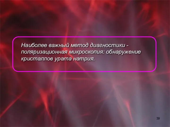 Наиболее важный метод диагностики - поляризационная микроскопия: обнаружение кристаллов урата натрия.