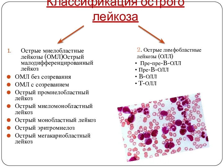 Классификация острого лейкоза Острые миелобластные лейкозы (ОМЛ)Острый малодифференцированный лейкоз ОМЛ