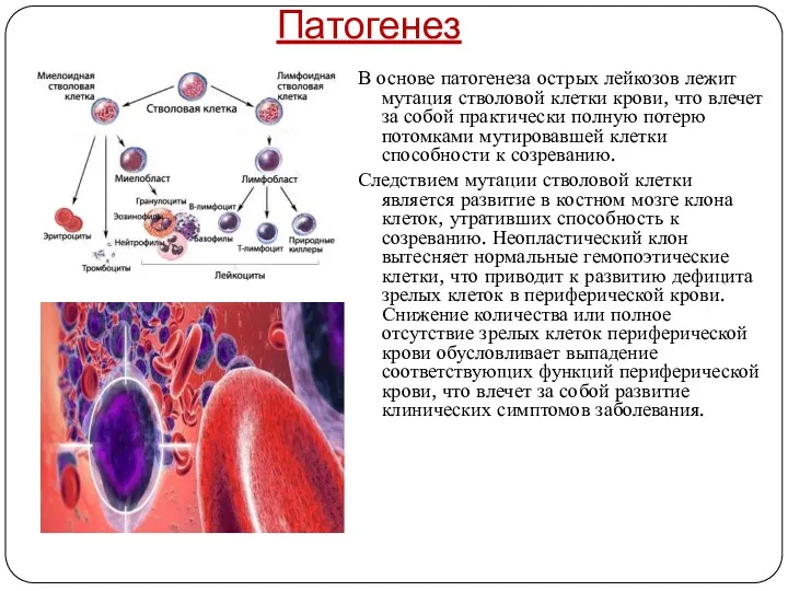 Патогенез В основе патогенеза острых лейкозов лежит мутация стволовой клетки