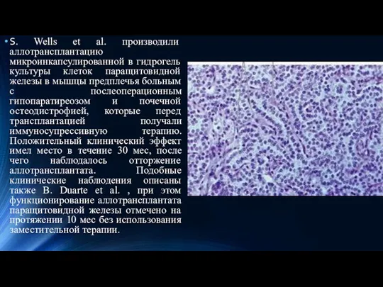 S. Wells et al. производили аллотрансплантацию микроинкапсулированной в гидрогель культуры