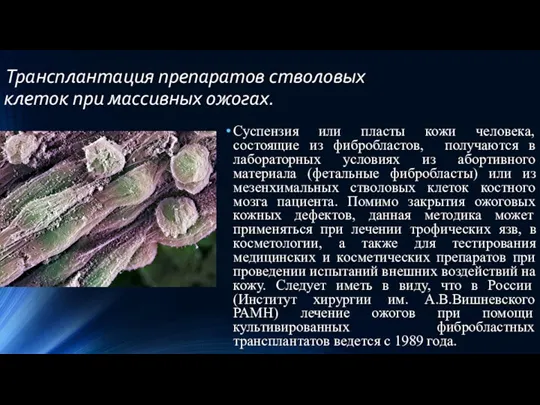 Трансплантация препаратов стволовых клеток при массивных ожогах. Суспензия или пласты